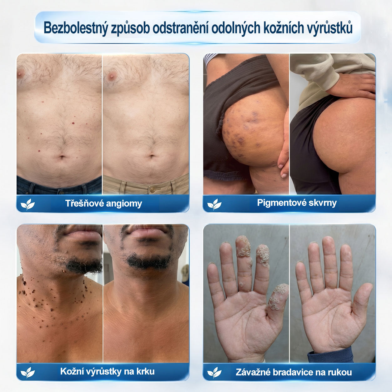 Oficiální značkový obchod🌱🌱|🖊️𝐏𝐢𝐜𝑑𝑜® 𝟩𝖽𝖾𝗻𝗻í 𝘰𝘥𝘴𝘵𝗋𝖺ň𝗈𝗏𝖺č 𝒔𝒌𝒗𝒓𝙣 𝙖 𝙥𝙞𝙜𝙢𝙚𝙣𝙩𝘰𝘷ý𝘤𝘩 𝘴𝘬𝖛𝖗𝖓 (Bezbolestný rollerball bez jizev)
