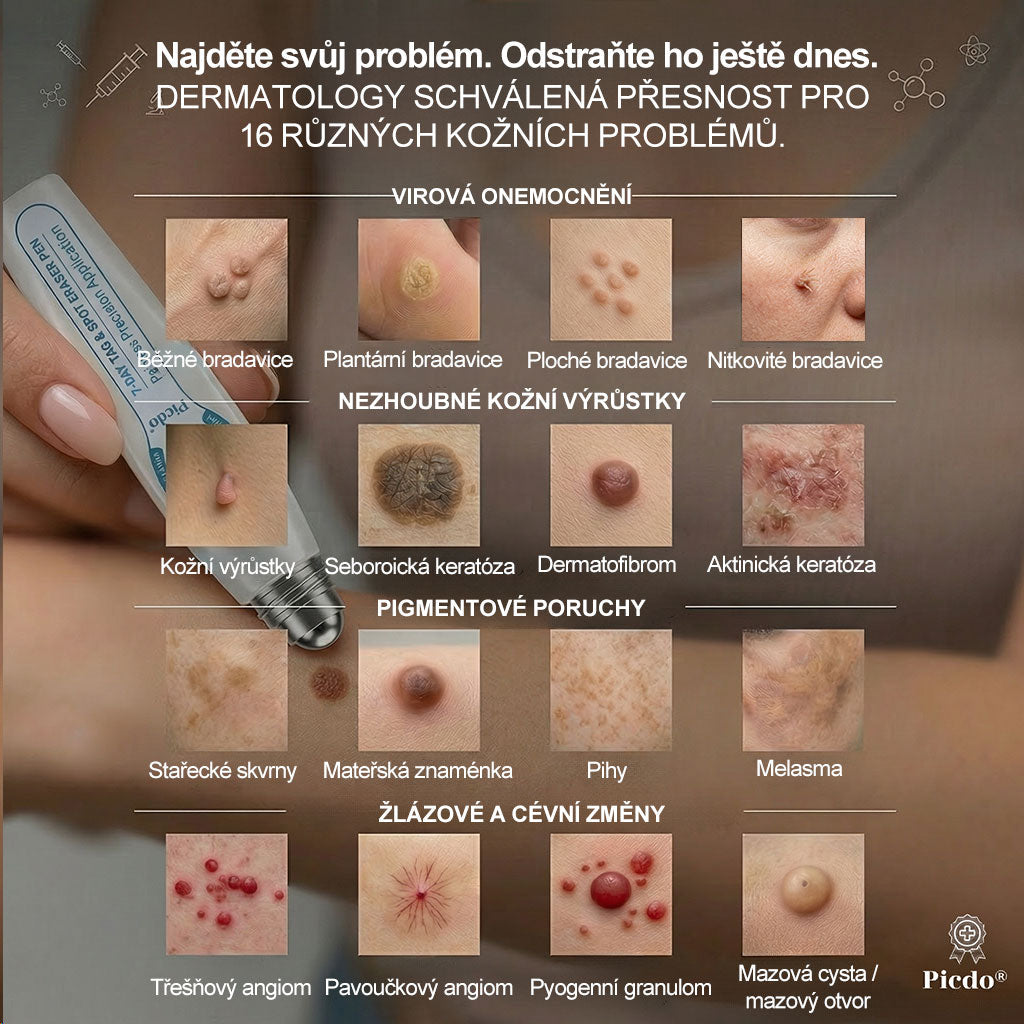 Oficiální značkový obchod🌱🌱|🖊️𝐏𝐢𝐜𝑑𝑜® 𝟩𝖽𝖾𝗻𝗻í 𝘰𝘥𝘴𝘵𝗋𝖺ň𝗈𝗏𝖺č 𝒔𝒌𝒗𝒓𝙣 𝙖 𝙥𝙞𝙜𝙢𝙚𝙣𝙩𝘰𝘷ý𝘤𝘩 𝘴𝘬𝖛𝖗𝖓 (Bezbolestný rollerball bez jizev)